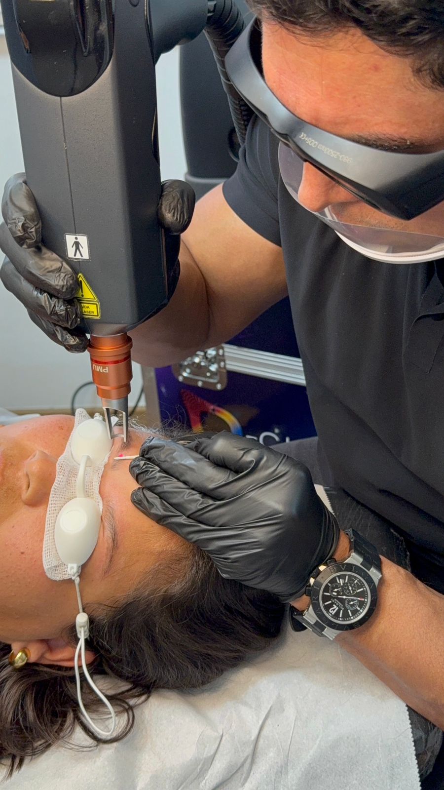 Remoção de Micropigmentação